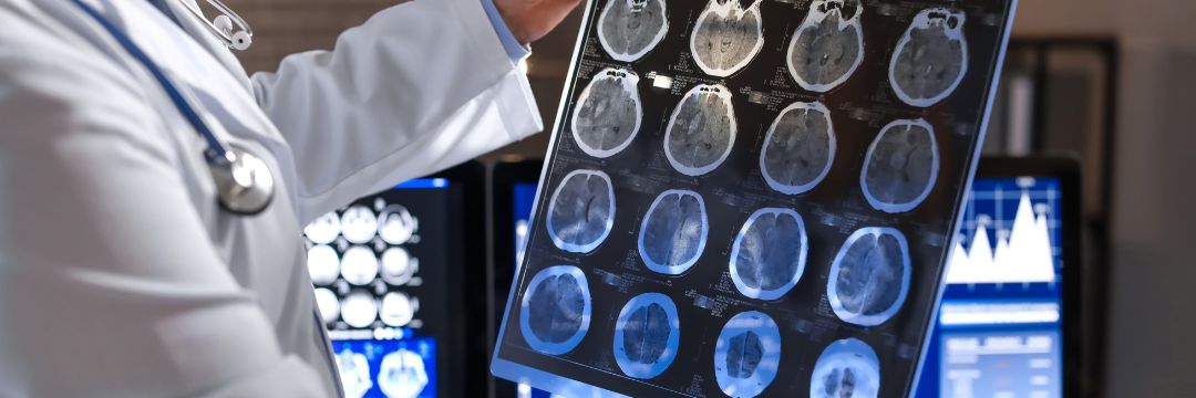 Neurology Doctor CT MRI Haldwani Sai Hospital