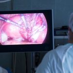 Laparoscopy Sai Hospital Haldwani