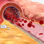 Pulmonary Artery Sai Hospital for Best pulmonologist