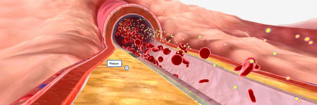 Pulmonary Artery Sai Hospital for Best pulmonologist