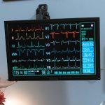 What is Interventional Cardiology Available in Haldwani