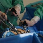 Is Laparoscopy Painful - Myth Busting, Sai Hospital Haldwani