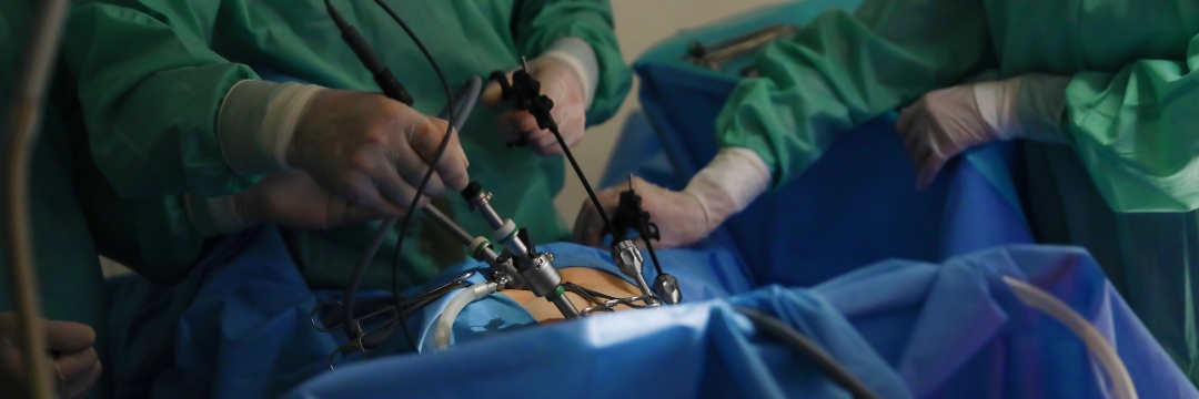 Is Laparoscopy Painful - Myth Busting, Sai Hospital Haldwani