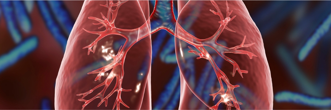 What is Pulmonary Hypertension | Sai Hospital Haldwani Treatment