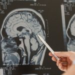 What is A Brain Doctor Called | Sai Hospital Haldwani