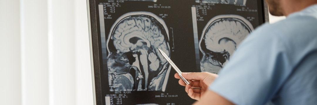 What is A Brain Doctor Called | Sai Hospital Haldwani
