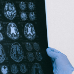 How to Read CT Scan – Explained | Sai Hospital, Haldwani