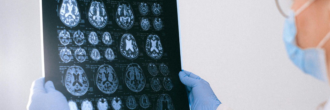 How to Read CT Scan – Explained | Sai Hospital, Haldwani