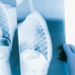 How to Check X Ray Report in Haldwani – Answered
