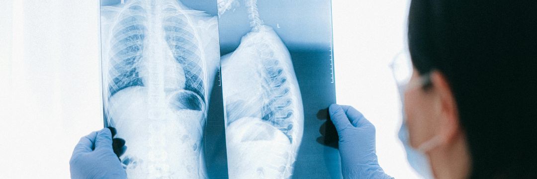 How to Check X Ray Report in Haldwani – Answered