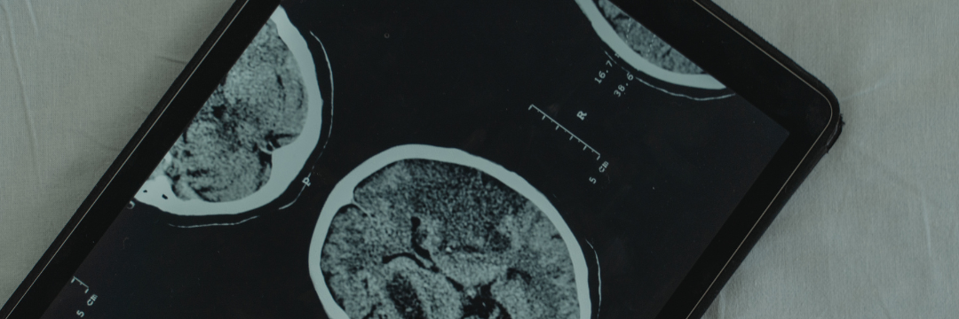 how to perform a neurological assessment | sai hospital haldwani