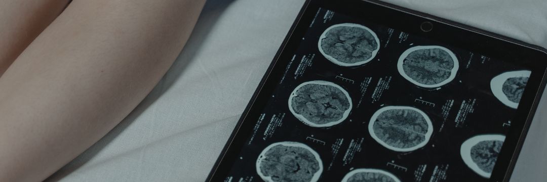 What Are Some Neurological Disorders? Explained by Sai Hospital, Haldwani