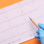 Is Interventional Cardiology Worth It? | Sai Hospital, Haldwani