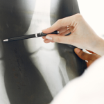 What Are Common Orthopedic Problems? | Sai Hospital, Haldwani